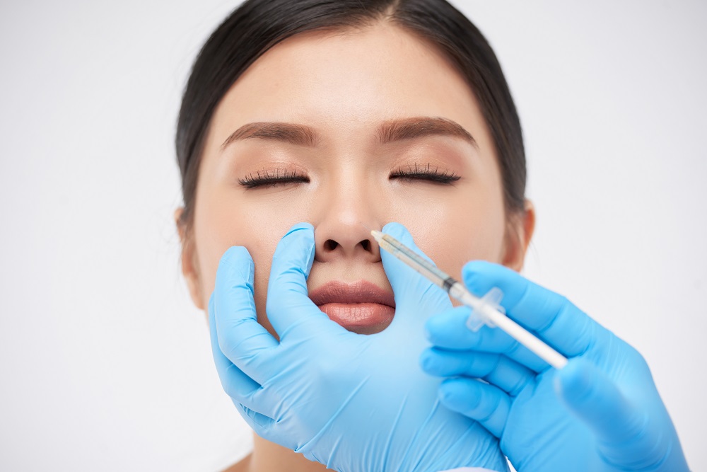 Aplicación de ácido hialurónico en rinomodelación nasal